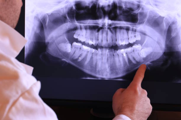 Best Emergency Tooth Extraction in Coord, NC