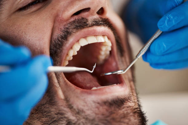 Best Emergency Treatment for Toothache in Coord, NC
